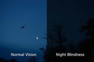 Night blindness